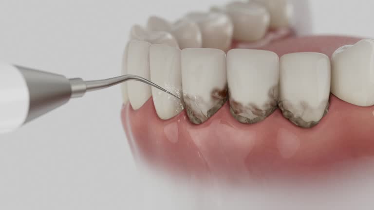 Reliable Dental Implants contractor in Negaunee, MI by Smile Center Dentistry